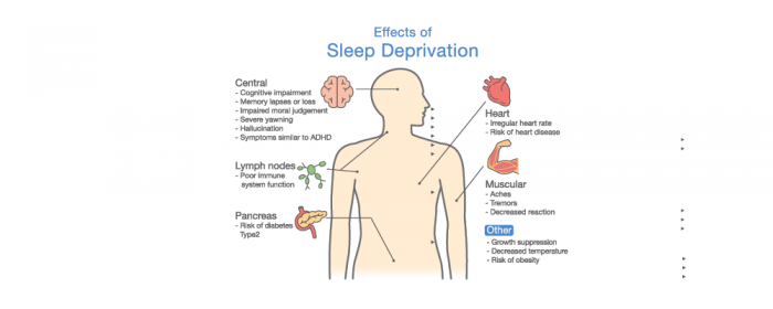 effects of sleep deprivation